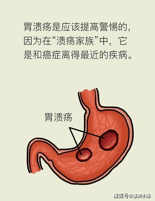 d9cc95309f1b462b93ac0d434532d336.png