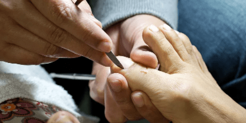 传统的修脚刀片和一次性的修脚刀片有什么区别飞万