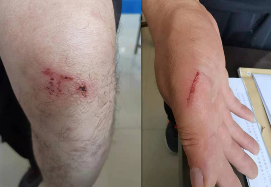 经再三确认车主身体无大碍后,杨雄,王斌将车辆扶至路旁.