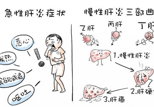 成语什么肝沥胆_成语故事简笔画(3)