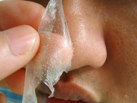 方法|最火的几种去黑头的方法，求求你千万不要再做了！