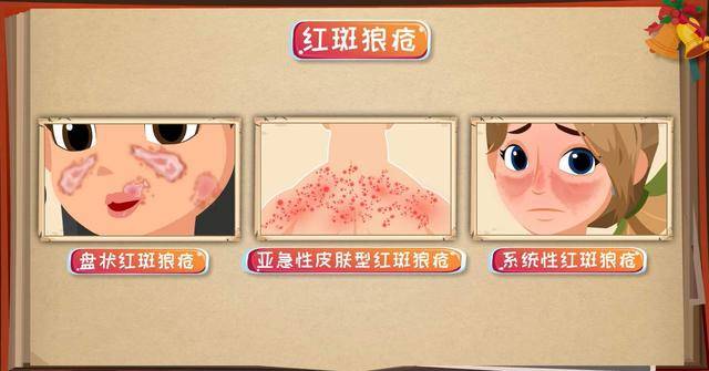 红斑狼疮为何女性是高发人群,从何而来?