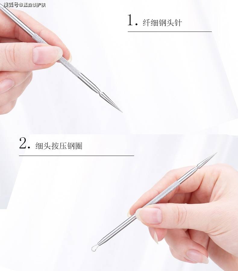 针刺|黑头、闭口、痘痘,要不要做“针清”?