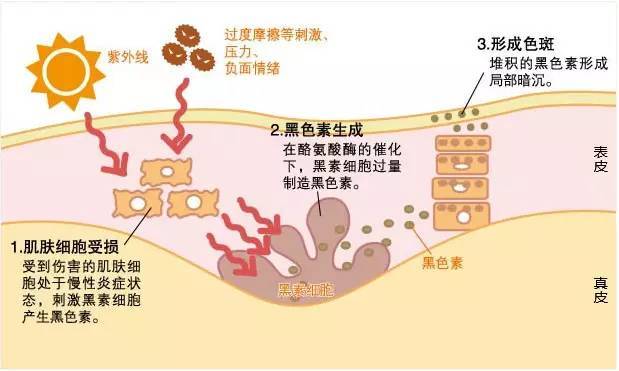 关键|暗沉、色斑显老又显丑？4招教你轻松解决，28天养出嫩白水光肌