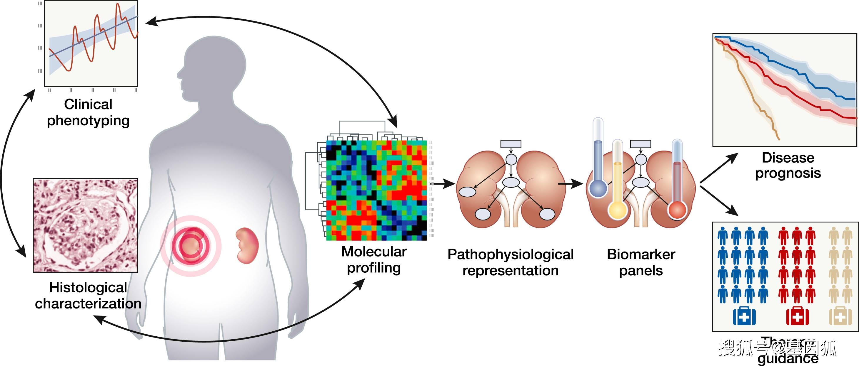 科普|健康科普:糖尿病肾病关键基因有哪些?