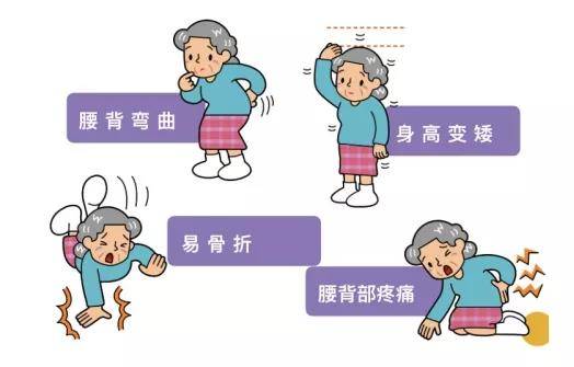 老人|老人经常腰酸背痛，需要做做这项检查