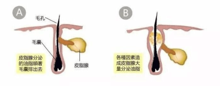 护肤品|真正懂成分的人，会买什么护肤品？