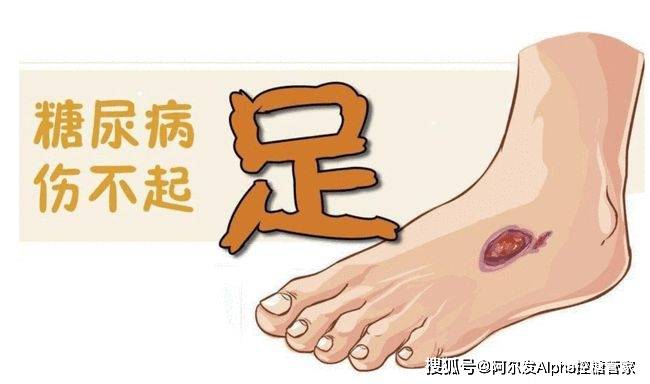 心脑血管|糖尿病预防并发症全攻略