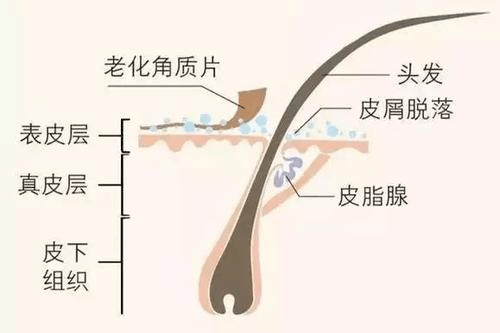 头皮|头皮护理有必要做吗？这些走心大实话讲给你听