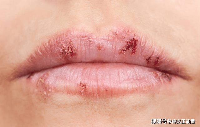 肺癌上门,身体先知!一旦身体3处"变丑",需尽早去检查