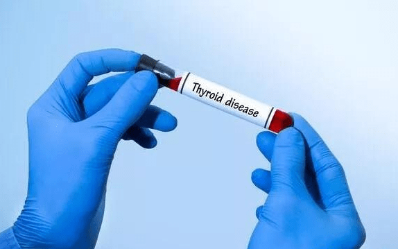 知识科普|甲状腺专家王占荣主任分享:三分钟了解甲状腺功能异常的表现,以及治疗方法