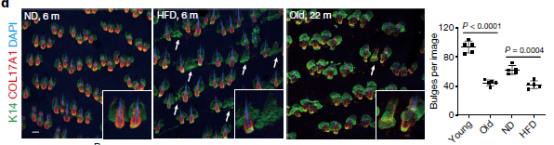 毛囊|肥胖真会引起脱发！Nature最新科研成果揭晓关键秘密……