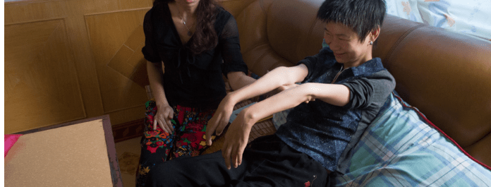 延髓|运动神经元病有什么明显的症状