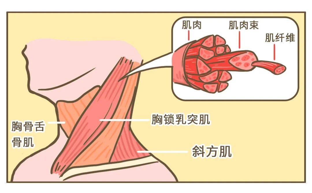 的睡姿和不舒適的枕頭,使頸部肌肉長時間處於過度伸展或屈曲的狀態