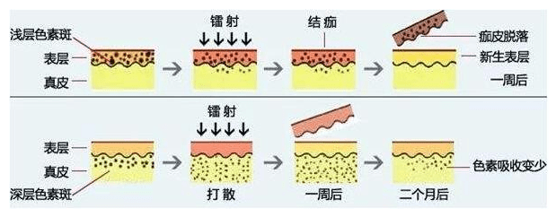 效应|这个祛斑的好帮手，我不允许你不知道