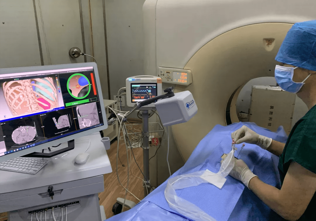 一附院成功实施西北多台首例智能导航机器人引导下精准介入治疗手术