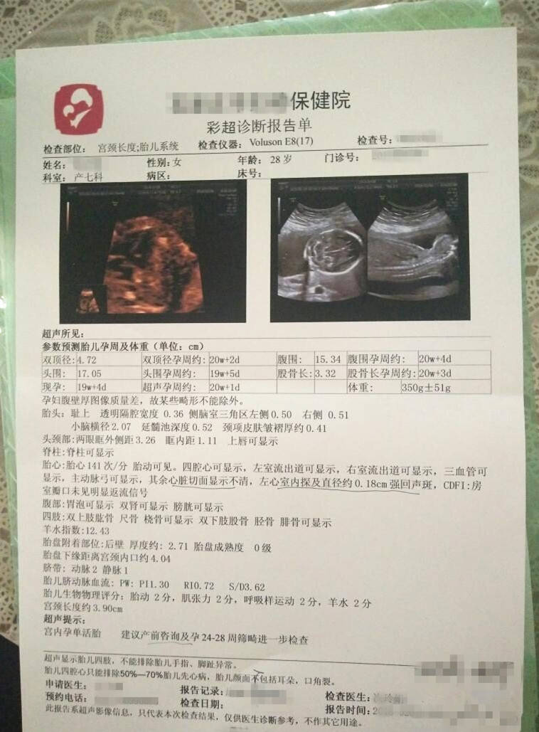 怀孕六周是指几天 48d2c5fb32c84b84bc78ae202708dbed.jpeg