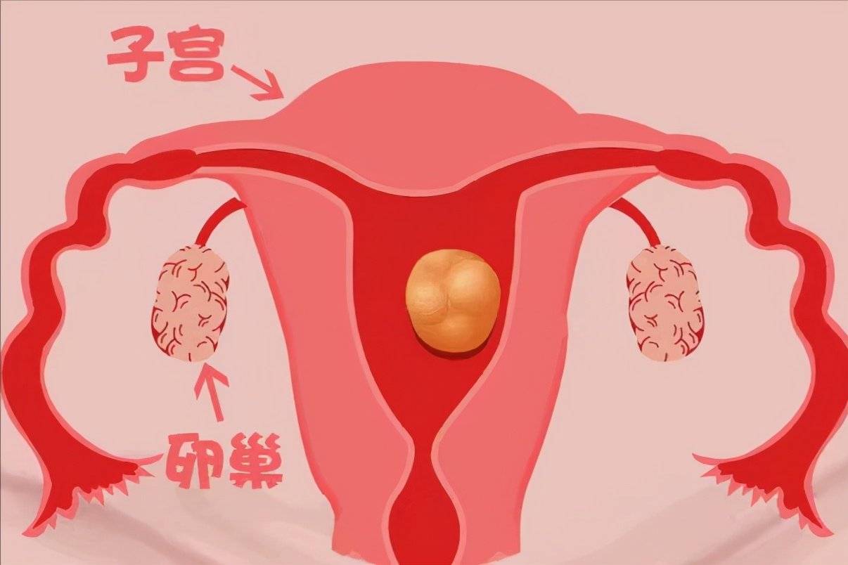 卵巢囊肿不用管?要分清楚其类型,病理性囊肿的危害要当心