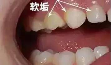 c3c43f174c194b1c882c82001a36d2b3.jpeg