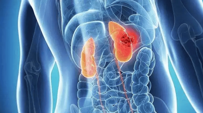 什么是电解质紊乱的10大症状表现 d0e06d9d485549e2bed2a3247aa9d7aa.png