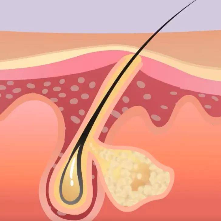 头皮|女神变得不爱见人，是什么让她如此自卑……