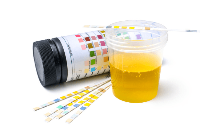 变化|蛋白尿总反复？有些不加药也能好！有2种情况较特殊