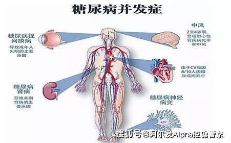 并发症|糖尿病常用知识点总结