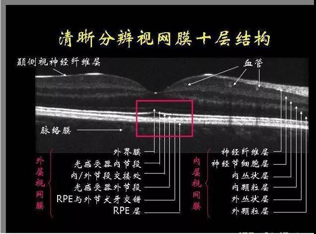 检查|眼睛出现闪光感 是怎么回事？