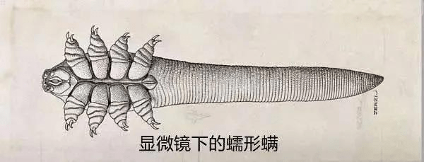 眼蠕形螨是一种寄生虫,喜欢寄生在眼部的毛囊和皮脂腺内,破坏眼表微