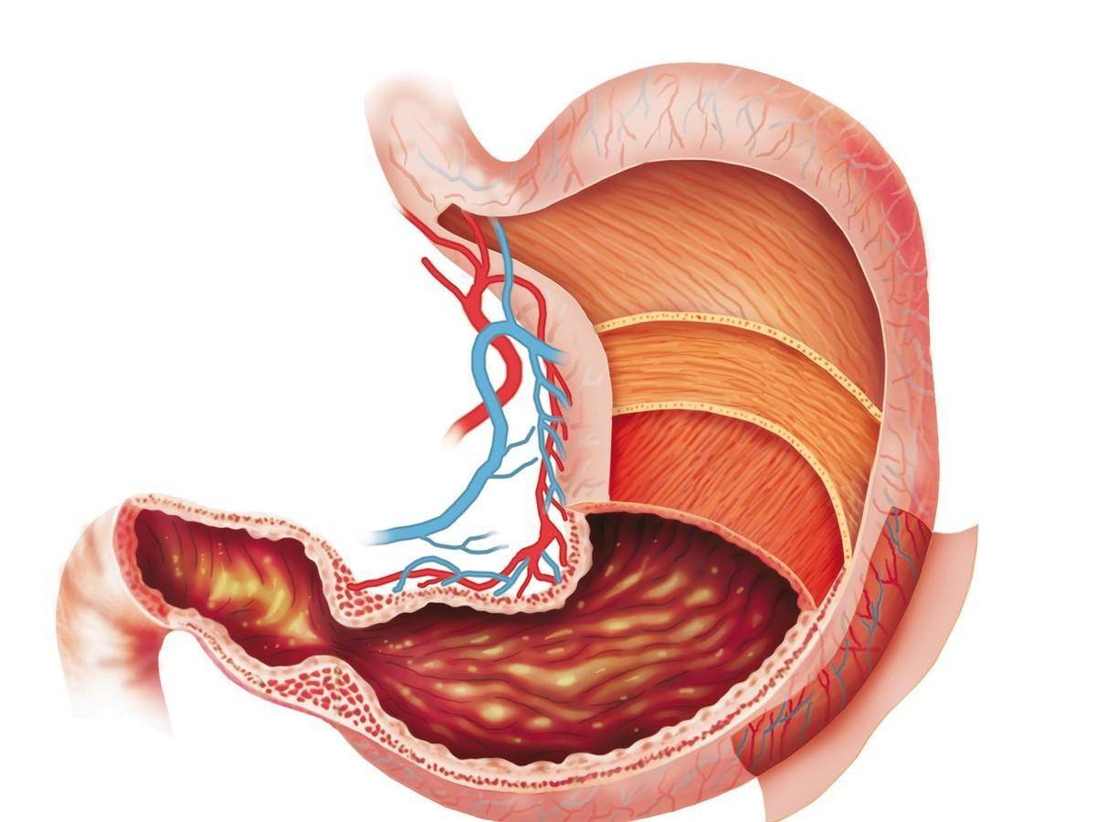 什么|消化不良的原因是什么?可能是这7种疾病
