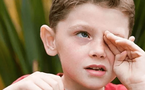 经常揉眼睛的7个严重后果必须要知道