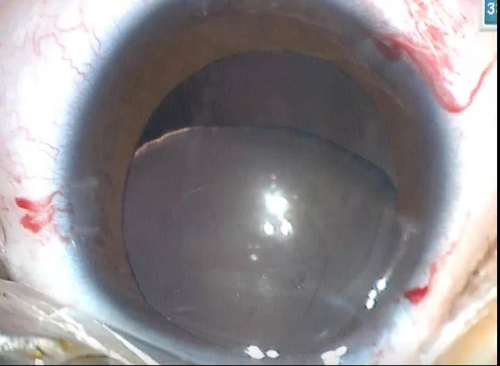 第一医院|西安市第一医院的提升与超越