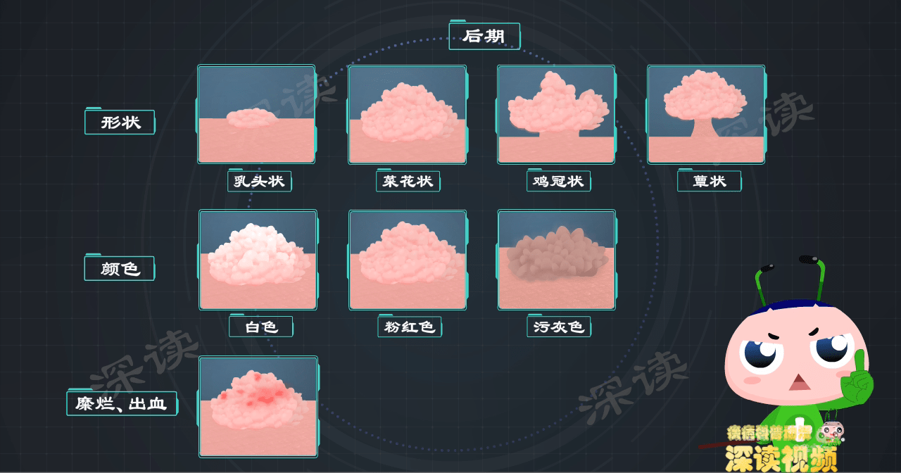 皮损后期逐渐增多,增大,表现为乳头状,菜花状,鸡冠状及蕈状赘生物