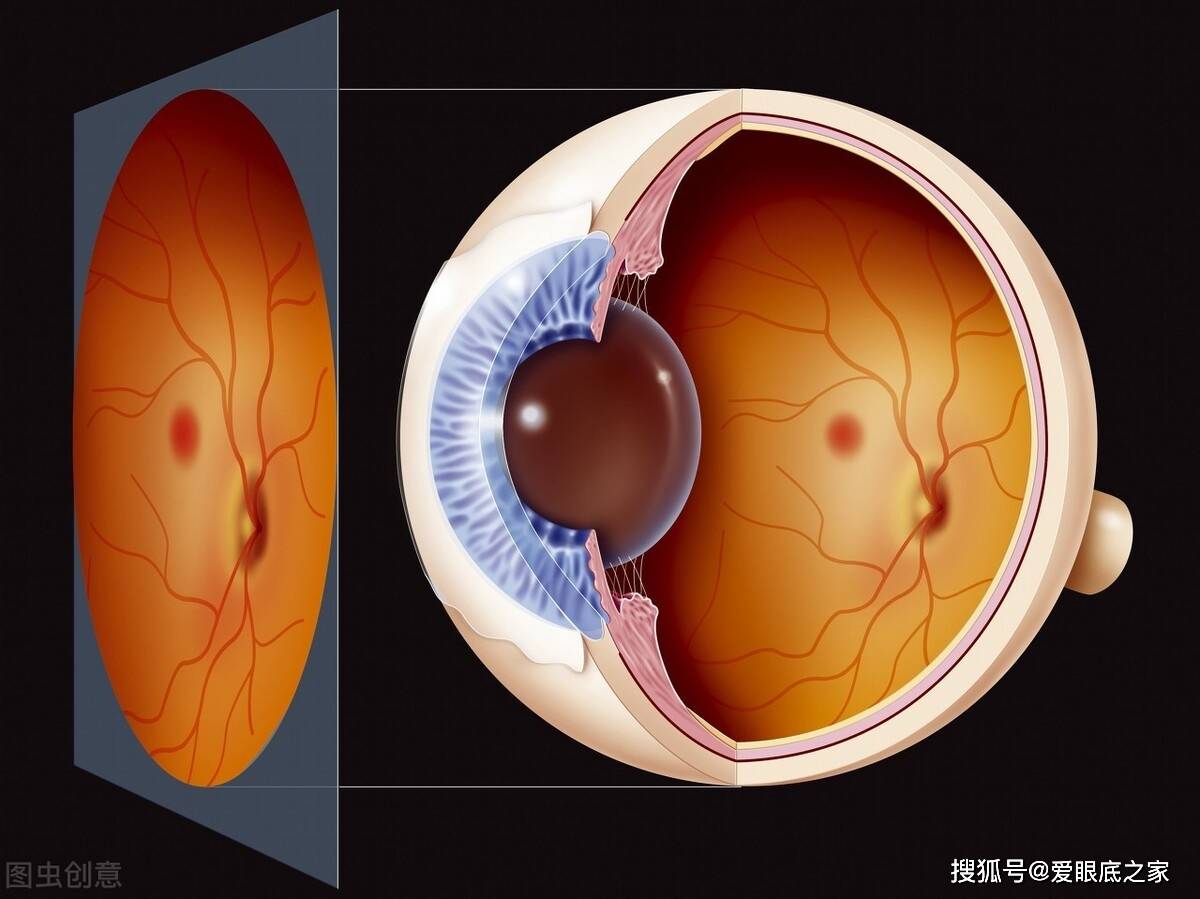5,激光扫描眼底镜(slo):激光扫描眼底镜(slo)的成像原理是利用激光