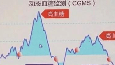 因为|李爱国主任分享：糖尿病患者，若身上出现2个现象，血糖控制得还不错!