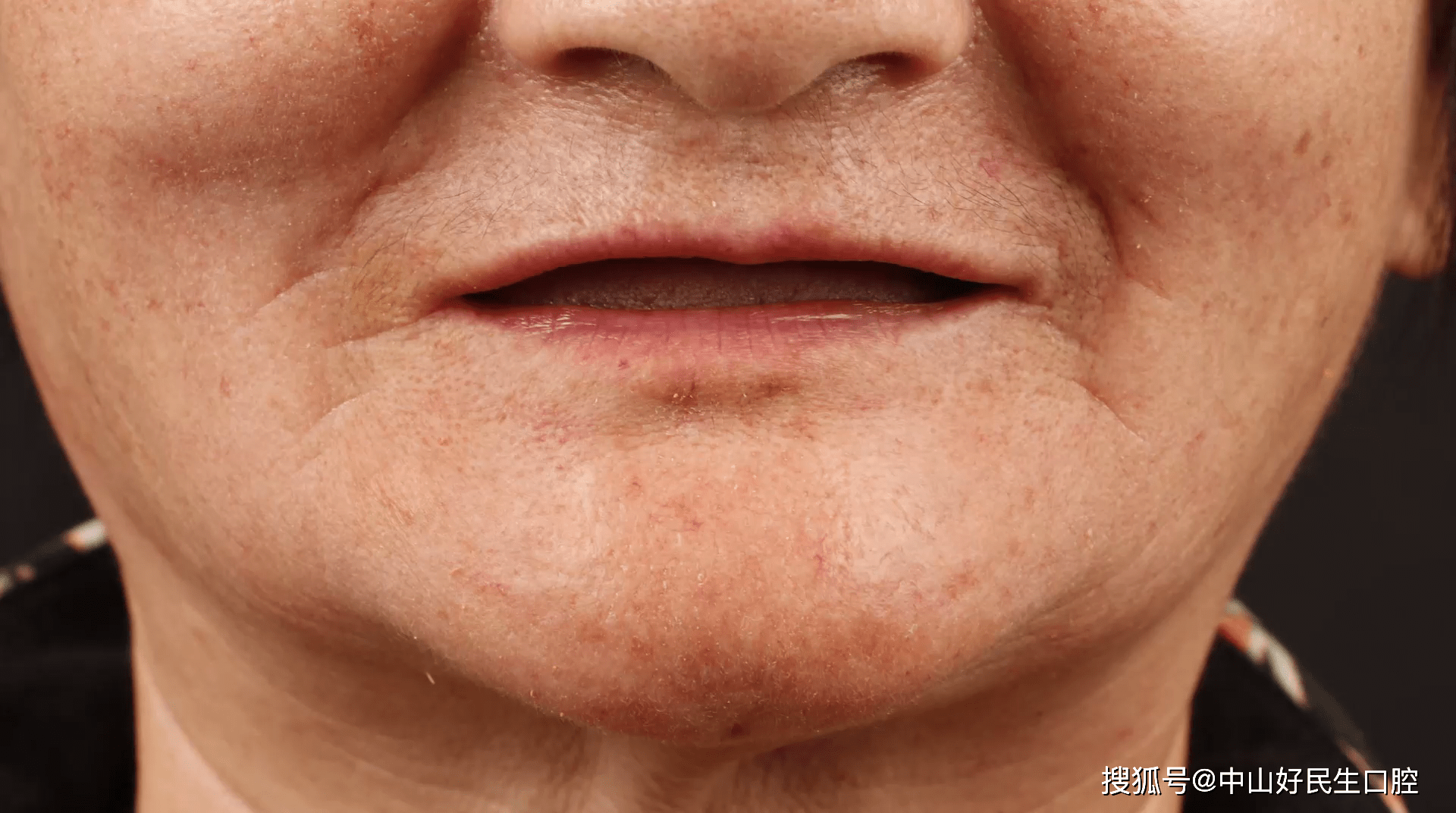 口腔|强强对决,这届口腔病例大赛精彩纷呈