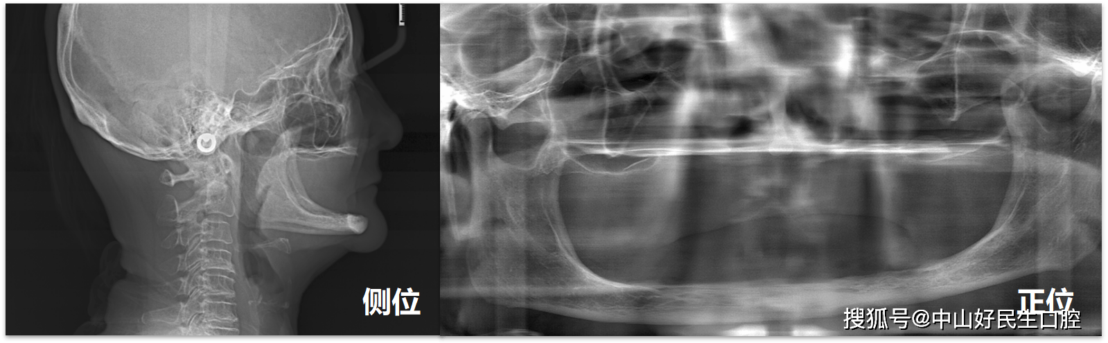 口腔|强强对决,这届口腔病例大赛精彩纷呈