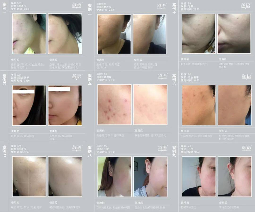 颜语二颜语二裂酵母精华水，用出了精华的护肤效果？是真的还是在吹？