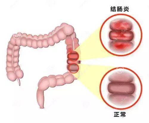 症状|台州京城中医医院预约真的方便吗？