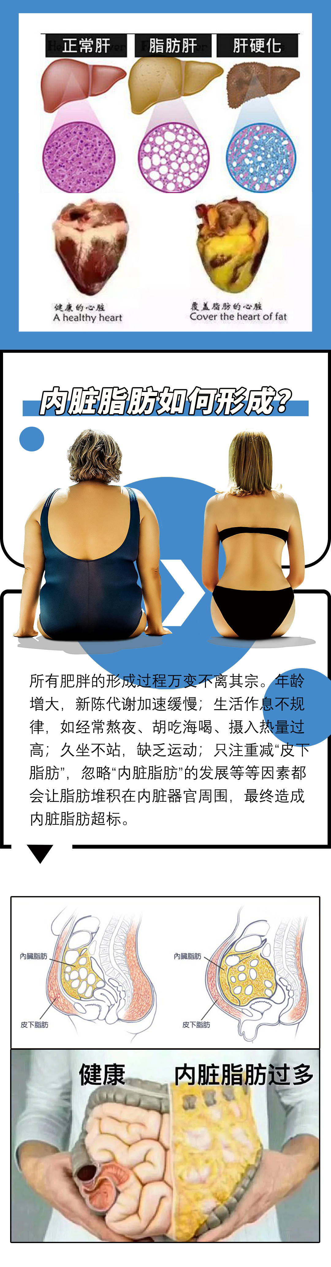 百病之源：内脏脂肪超标！