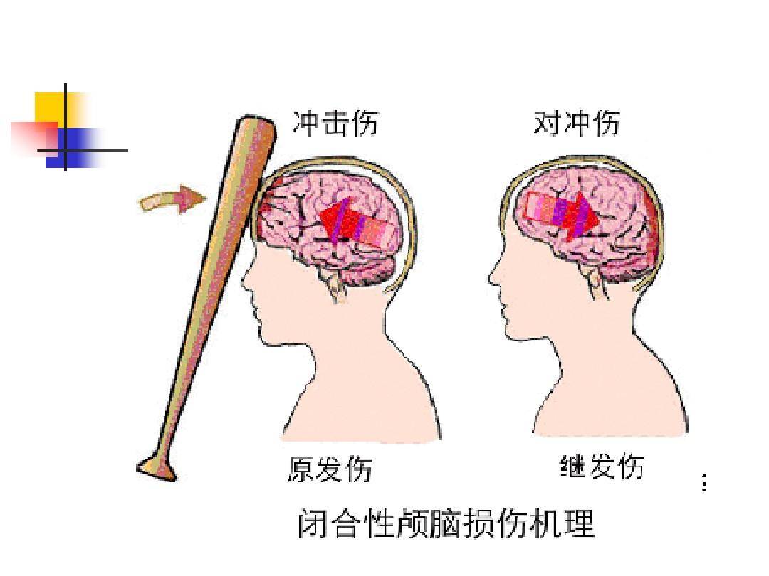 脑外伤后遗症有哪些?_控制_伤害_病情