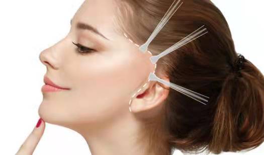 脸部脸部做大拉皮可以挺几年,脸拉皮手术能维持几年~