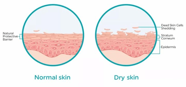 人体冬天到了，容易皮肤干燥瘙痒，补水保湿水乳推荐