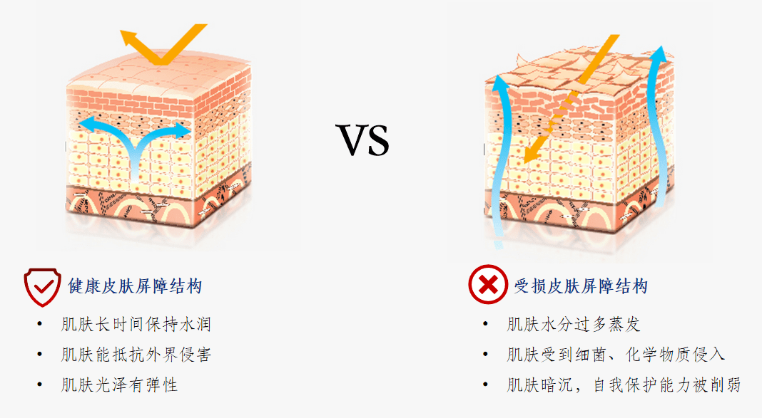 急救美肤课堂 | 颜值告急？换季女孩儿的急救护肤术