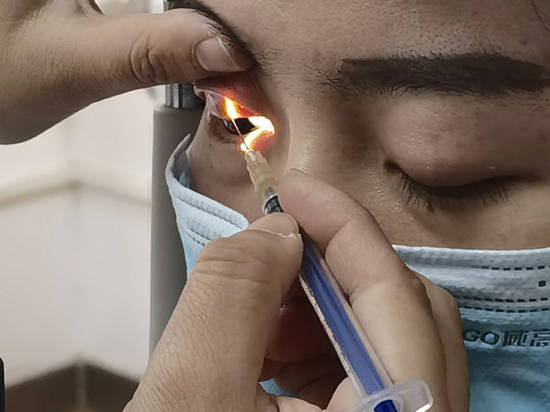 眼睛长出小沙粒划伤了角膜影响了视力眼结石怎么才能消除