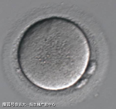受精卵|揭秘“试管婴儿”胚胎发育过程
