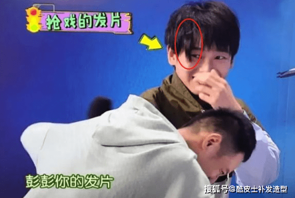 观点评论明星为了发际线有多拼？植发假发外加发际线粉，却败给胎毛王白鹿