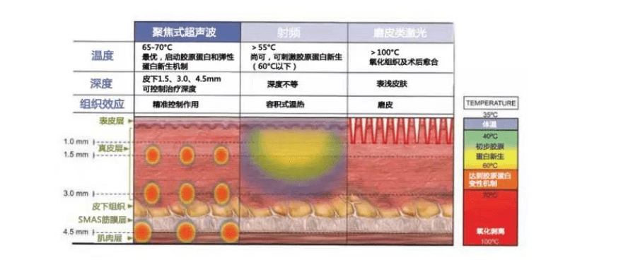 分析一篇关于超声、射频、激光的科普