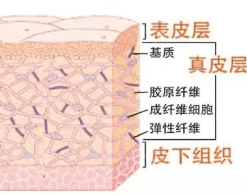 李佳佳皮肤科李佳佳：泪沟、颈纹严重怎么办？