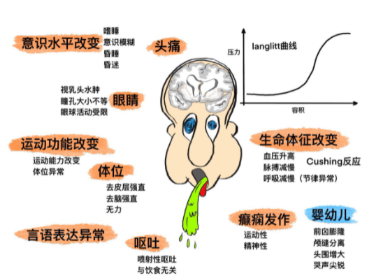 用于颅内压监测的光纤压力传感器